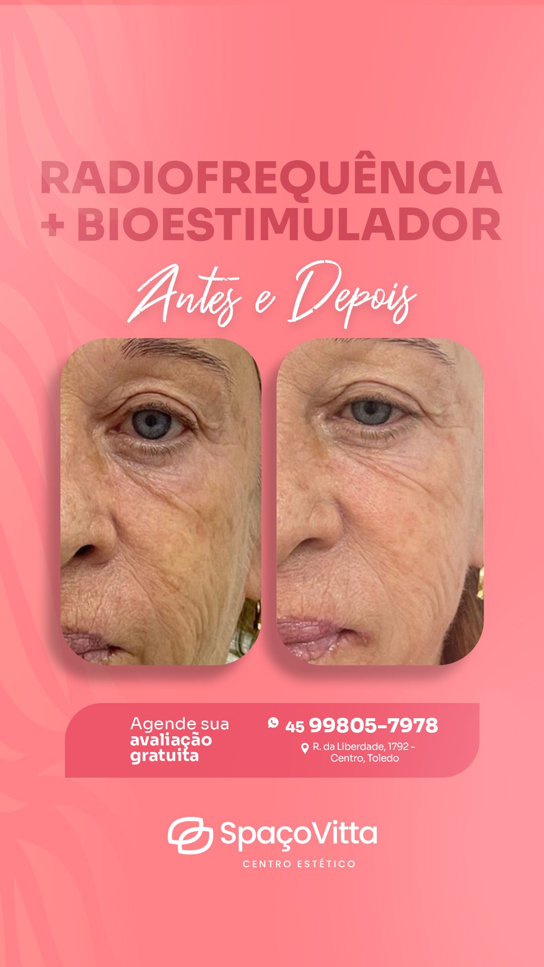 Social media para estética: peça 8 de 28