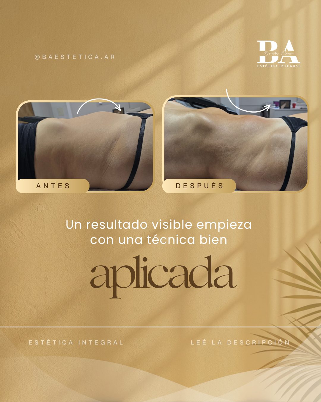 Social media para estética: peça 12 de 28