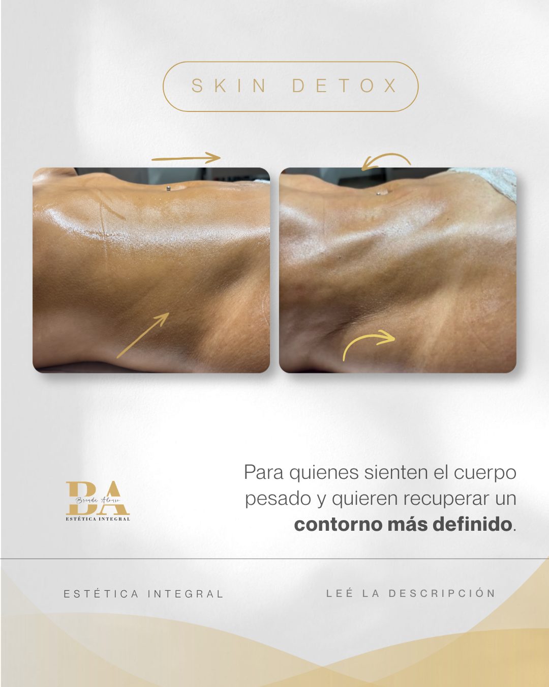 Social media para estética: peça 24 de 28